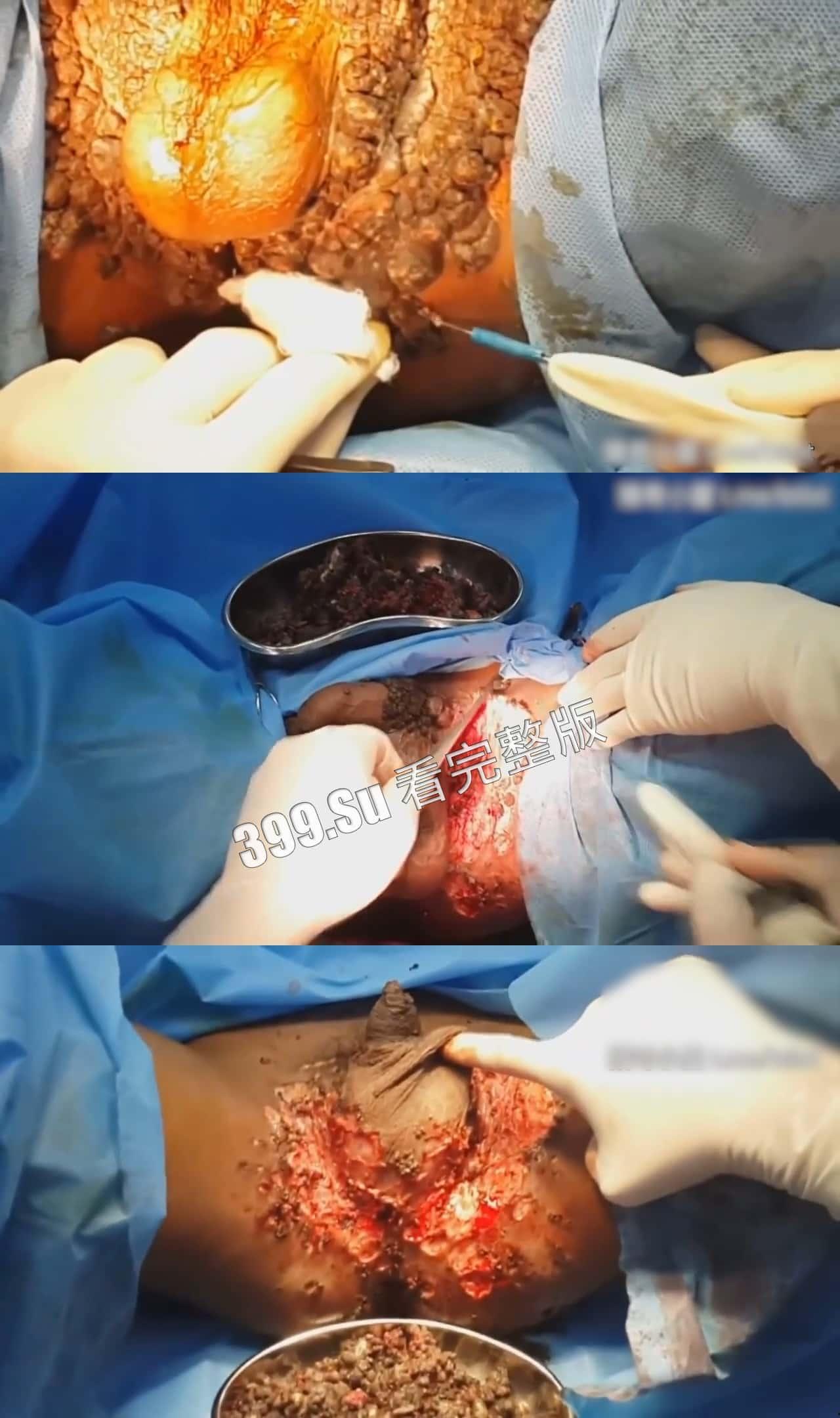 性病篇  谨慎观看！瓜友们出门在外 一定得洁身自爱 世界上没有后悔药  安全第一！！！-3