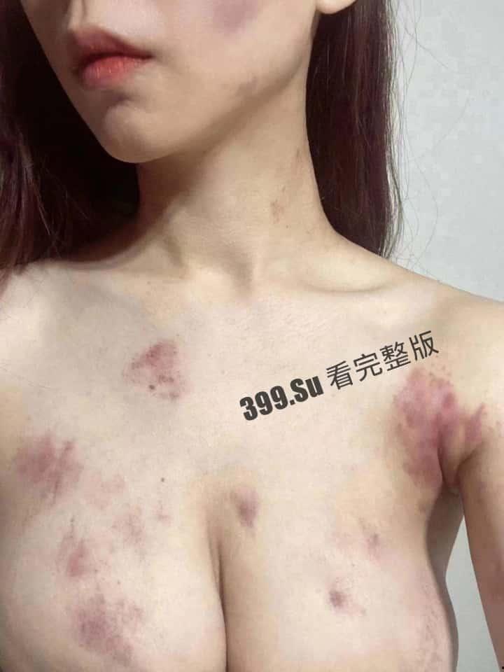 抖音百万粉丝博主 雅典娜 Liya 被闺蜜骗去菲律宾卖进妓院！惨遭毒打、强奸 奶子都被打得青一片紫一片-1