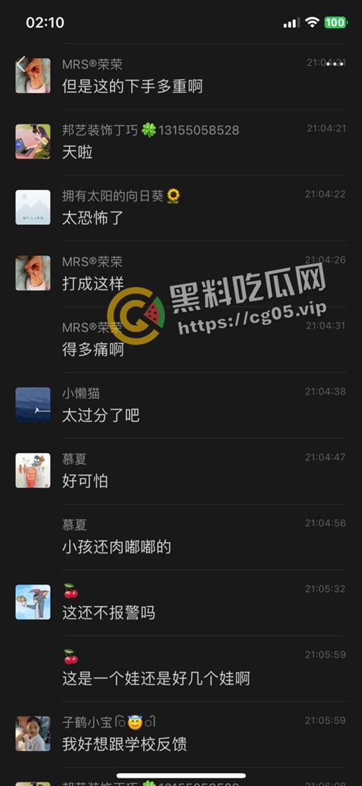 泰州外国语小学老师暴打小学生 全身淤青 家长群内声讨被解散 至今无说法-8