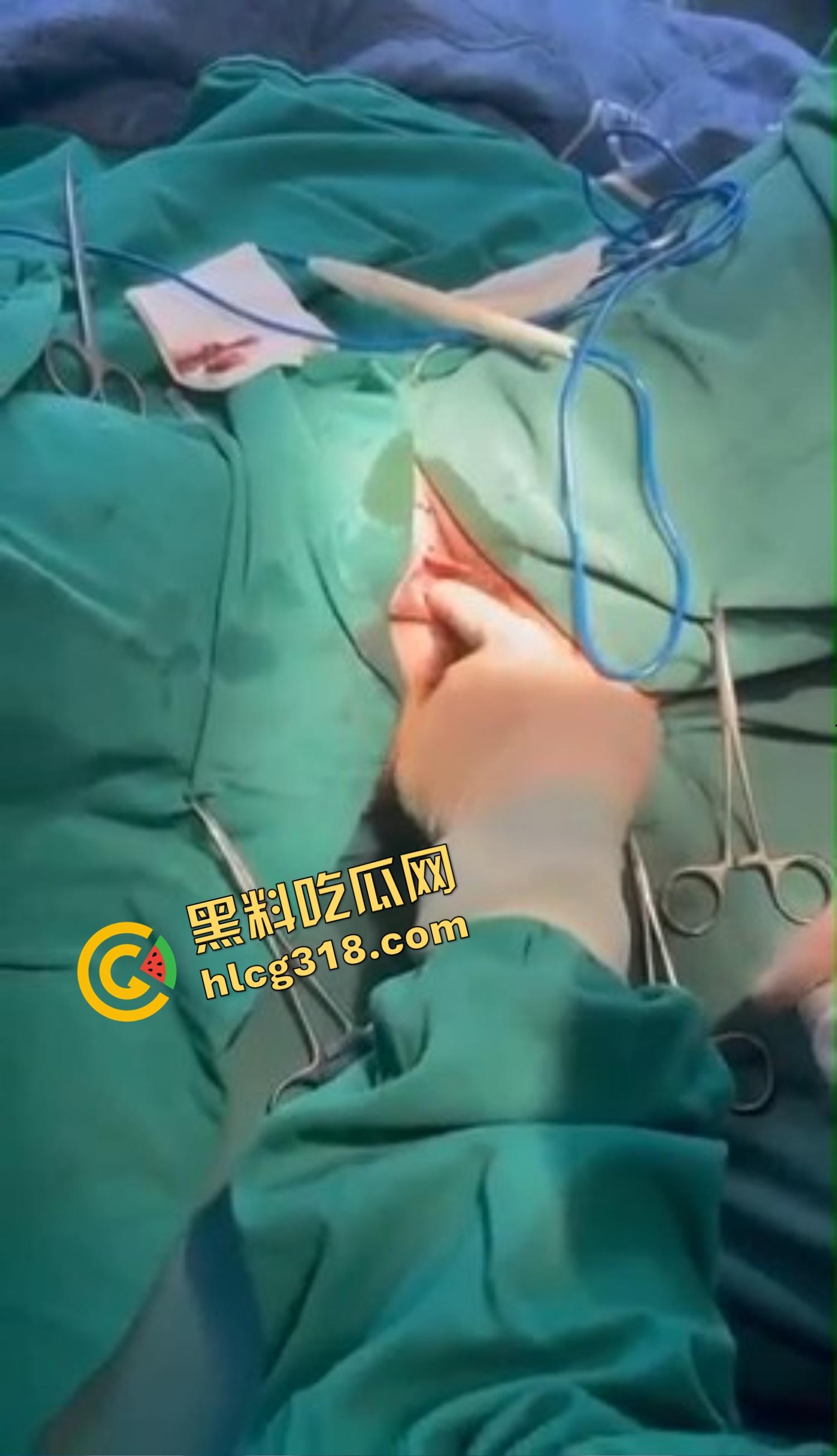 你还以为高端外围豪车天生紧？全靠阴道收缩术收成死夹货，富哥上手就说一根手指进去都得抹油！-7