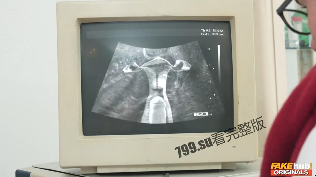 奥斯卡牛头人奖”获奖短片 老公陪老婆看医生 老婆被医生操了 监视器还能看到鸡鸡抽插-3