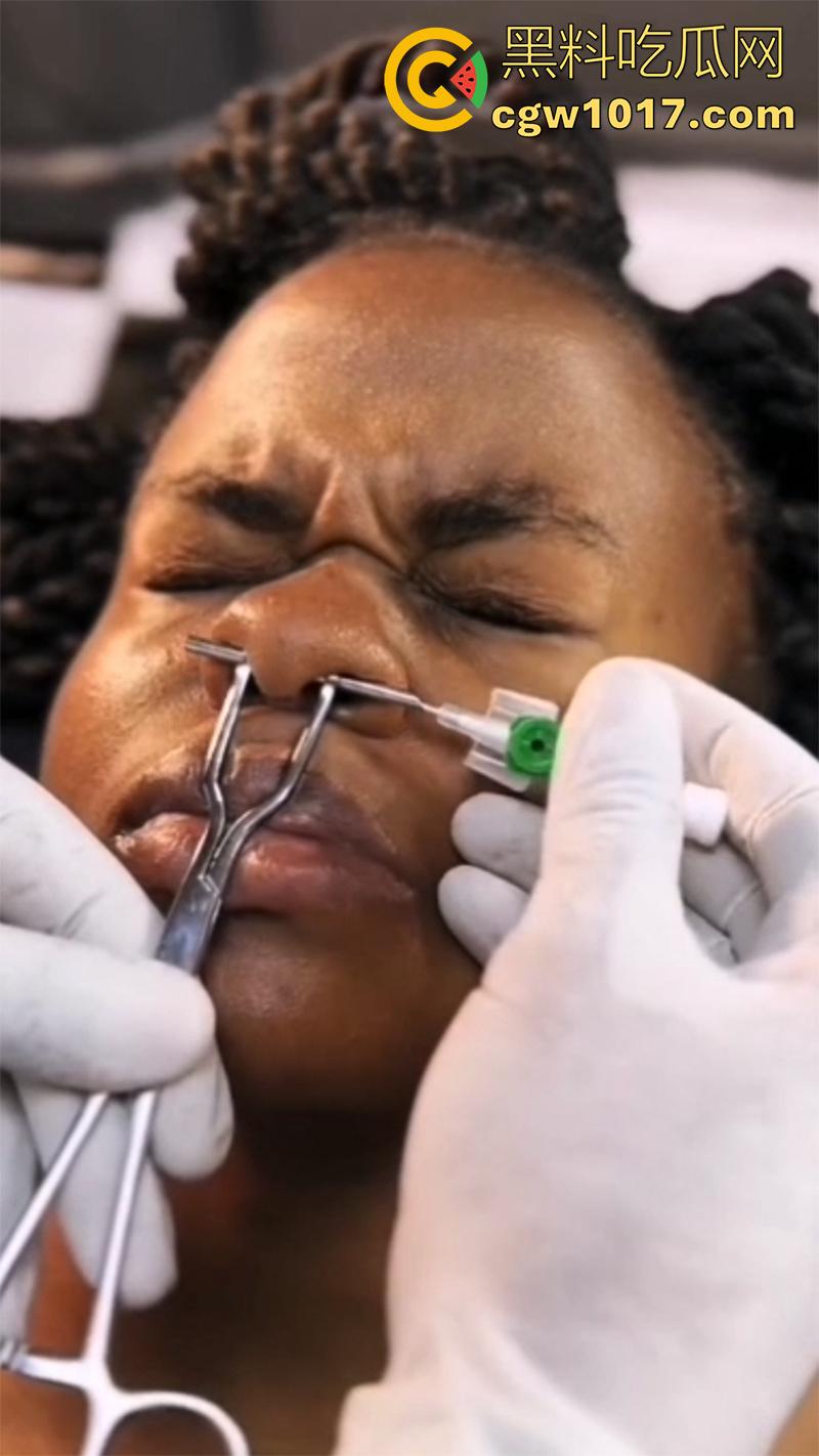 黑人女孩沉浸式穿刺，给鼻子打孔穿鼻环，这玩意不是牛才打的么，黑人竟然也好这口，难道是个小母牛？-2