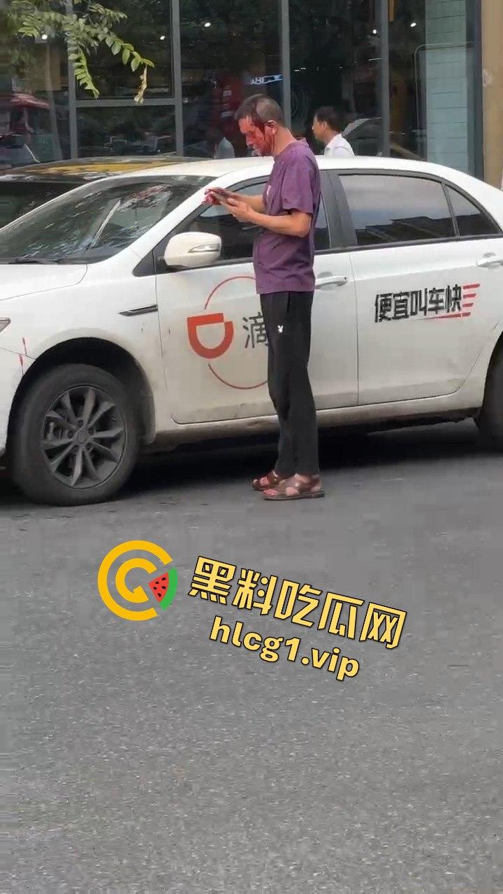 女子因价格争执叫来老公,掏出扳手开瓢,赔偿金额够买辆新车!-5