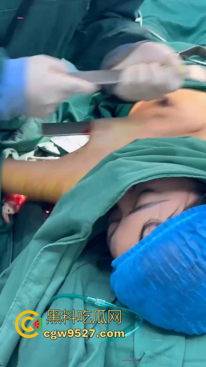 隆胸整形手术现场大曝光！平乳妹秒变巨乳御姐，手术过程一览无遗，女人为变美的代价真大！-1