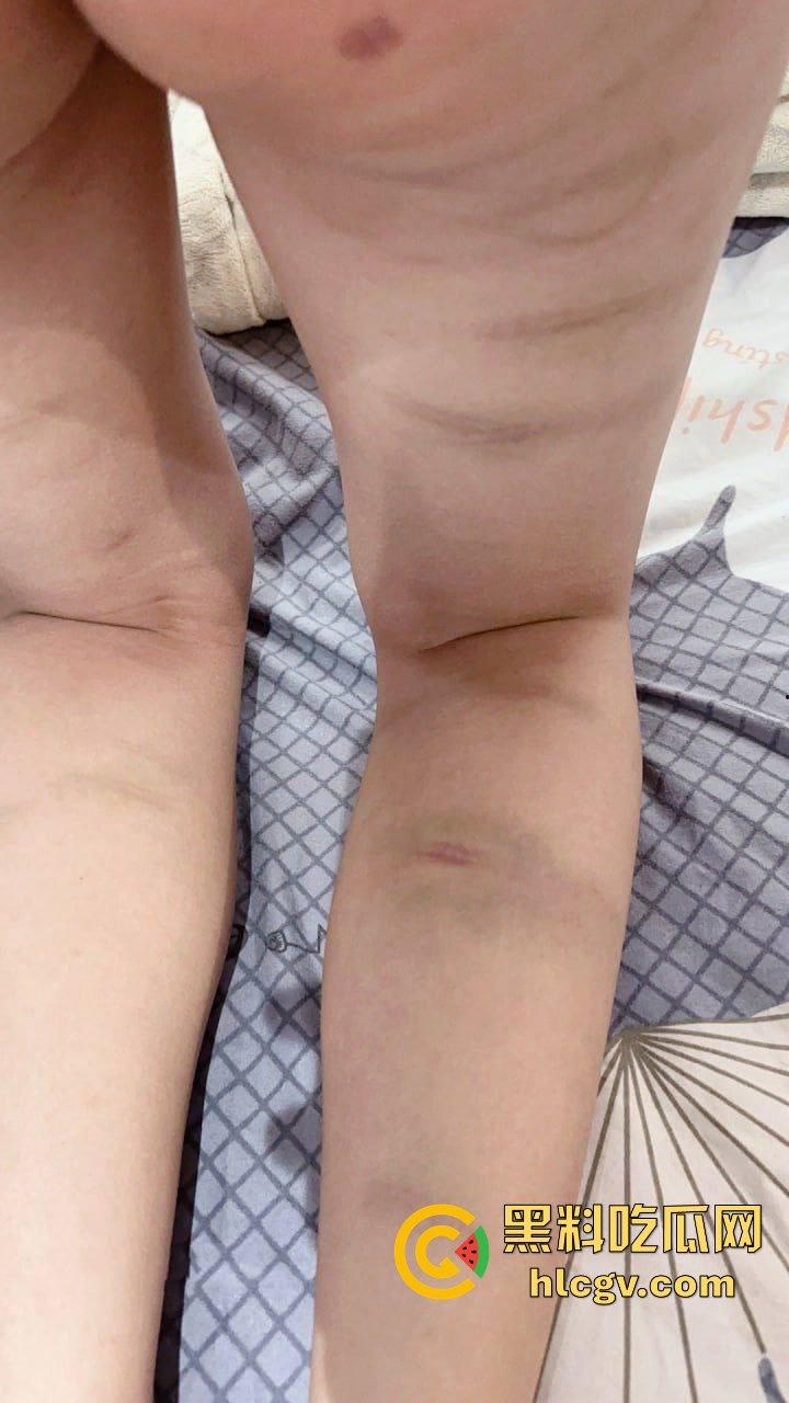 瓜友爆料约炮小红的悲惨故事，大专妹子被金钱调教，多人轮奸生活逼成这样，心疼不忍下屌！-10