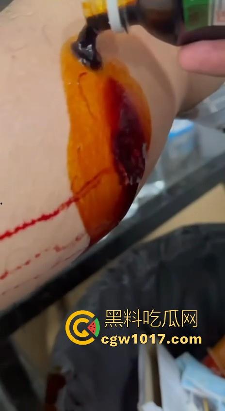 妙瓦底顺达园区缅甸KUN武装屠杀中国人！抢劫、轮奸、枪杀地盘之争，诈骗人员沦落为牺牲品，这时候你是中国人啦！-11