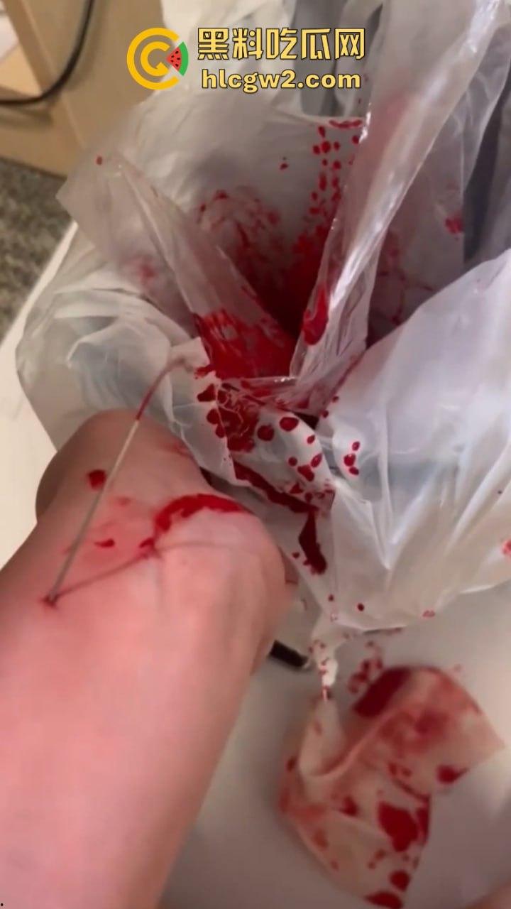 血腥慎入！推特十级脑残血腥自残自拍 残暴割腕引血自流 这是作死还是变态？-7